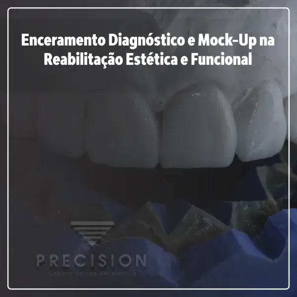 Enceramento Diagnóstico e Mock Up na Reabilitação Estética e Funcional