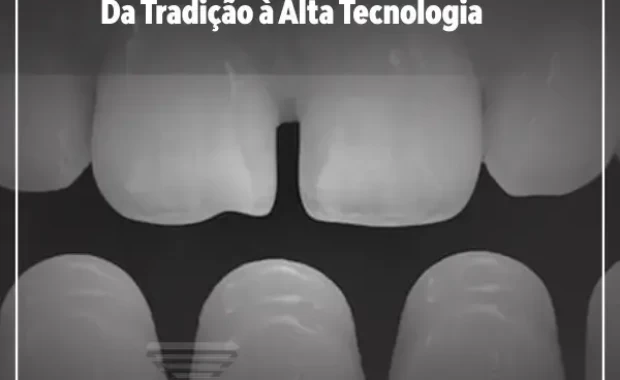 Evolução da Cerâmica na Odontologia: Da Tradição à Alta Tecnologia