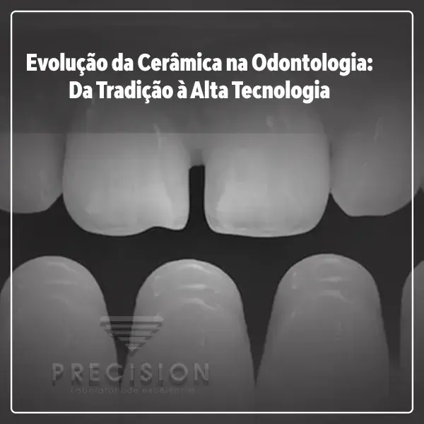 Evolução da Cerâmica na Odontologia: Da Tradição à Alta Tecnologia