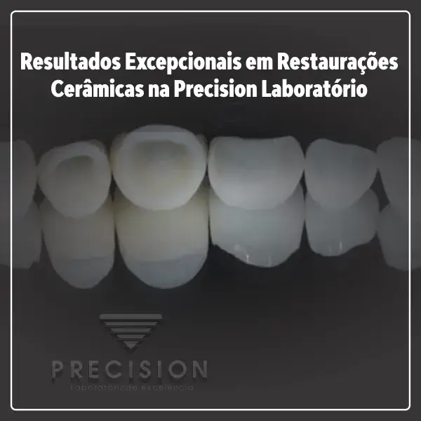Resultados Excepcionais em Restaurações Cerâmicas na Precision Laboratório