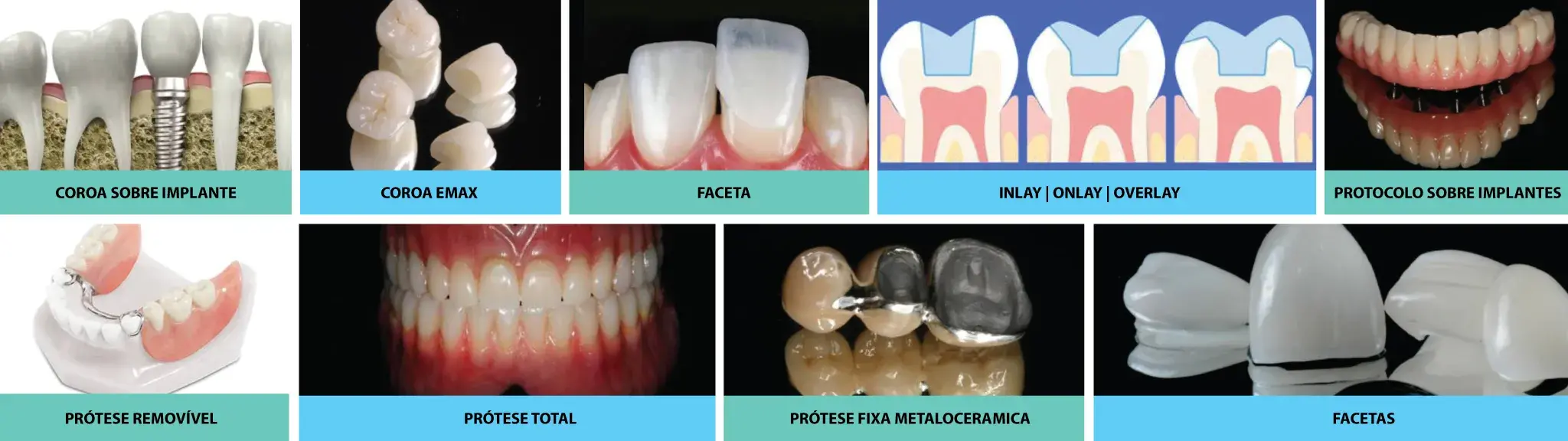 capa-post-processo-de-fabricacao-de-proteses-dentarias-de-excelencia-na-precision-laboratorio-em-sao-paulo